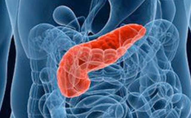 LINK DISCOVERED BETWEEN PANCREATIC CANCER AND GUM DISEASE